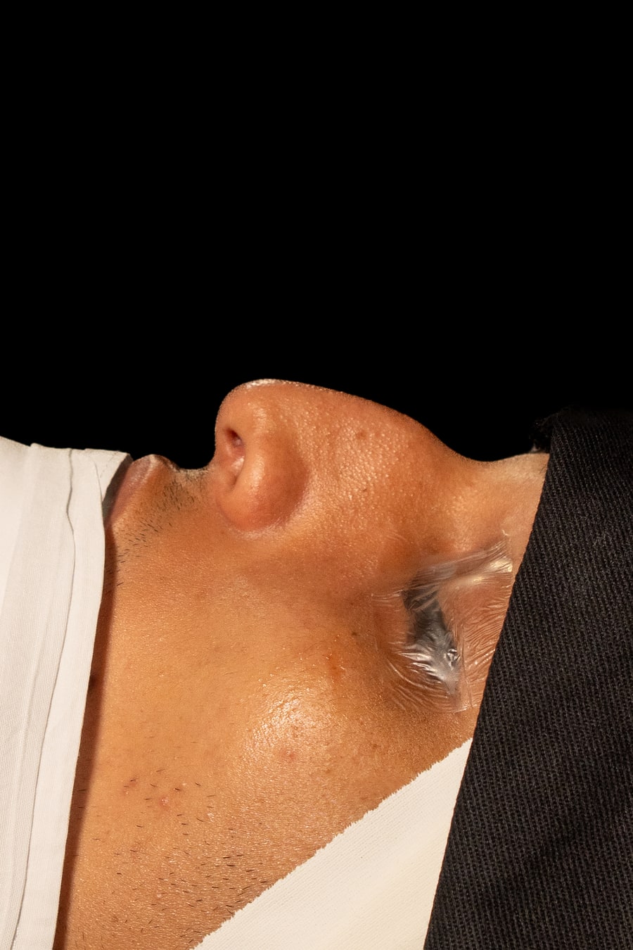 Caso 01 — antes, ângulo 3